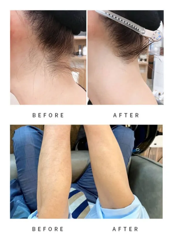 ビフォーアフター